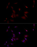 PGP9.5 Antibody in Immunocytochemistry (ICC/IF)