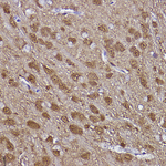 PGP9.5 Antibody in Immunohistochemistry (Paraffin) (IHC (P))