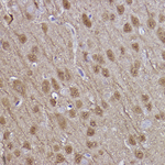 PGP9.5 Antibody in Immunohistochemistry (Paraffin) (IHC (P))