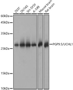 PGP9.5 Antibody in Western Blot (WB)