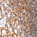 CD19 Antibody in Immunohistochemistry (Paraffin) (IHC (P))