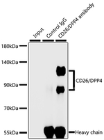 DPP4 Antibody in Immunoprecipitation (IP)