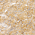 c-Met Recombinant Rabbit Monoclonal Antibody (2R6H7)