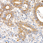 c-Met Antibody in Immunohistochemistry (Paraffin) (IHC (P))