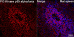 PI3 Kinase p85 alpha/beta Antibody in Immunohistochemistry (Paraffin) (IHC (P))