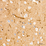PI3 Kinase p85 alpha/beta Antibody in Immunohistochemistry (Paraffin) (IHC (P))