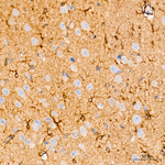 PI3 Kinase p85 alpha/beta Antibody in Immunohistochemistry (Paraffin) (IHC (P))