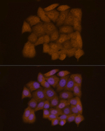 Galectin 3 Antibody in Immunocytochemistry (ICC/IF)