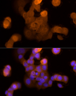 Galectin 3 Antibody in Immunocytochemistry (ICC/IF)