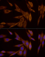 Galectin 3 Recombinant Rabbit Monoclonal Antibody (7Y3N8)