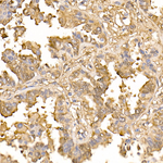 Galectin 3 Antibody in Immunohistochemistry (Paraffin) (IHC (P))