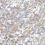 Ly-108 Recombinant Rabbit Monoclonal Antibody (9Z5G5)