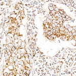 ATAD3A/B Antibody in Immunohistochemistry (Paraffin) (IHC (P))