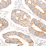 ATAD3A/B Recombinant Rabbit Monoclonal Antibody (4Z0B5)