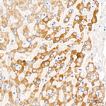 ATAD3A/B Antibody in Immunohistochemistry (Paraffin) (IHC (P))