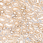 ATAD3A/B Antibody in Immunohistochemistry (Paraffin) (IHC (P))