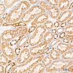 ATAD3A/B Antibody in Immunohistochemistry (Paraffin) (IHC (P))