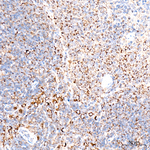 ATAD3A/B Antibody in Immunohistochemistry (Paraffin) (IHC (P))