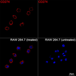 PD-L1 Recombinant Rabbit Monoclonal Antibody (5U9J6)