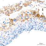 PD-L1 Antibody in Immunohistochemistry (Paraffin) (IHC (P))