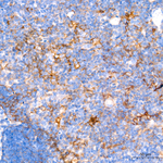 PD-L1 Antibody in Immunohistochemistry (Paraffin) (IHC (P))