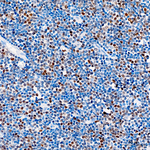 T-bet Antibody in Immunohistochemistry (Paraffin) (IHC (P))