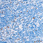 T-bet Recombinant Rabbit Monoclonal Antibody (10H6O1)