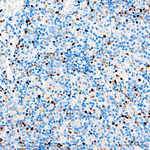 T-bet Antibody in Immunohistochemistry (Paraffin) (IHC (P))