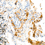 RAB5A Recombinant Rabbit Monoclonal Antibody (6M3K8)