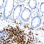 CD3 Antibody in Immunohistochemistry (Paraffin) (IHC (P))