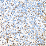 CD3 Antibody in Immunohistochemistry (Paraffin) (IHC (P))
