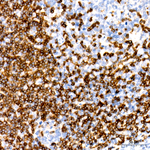 CD3 Antibody in Immunohistochemistry (Paraffin) (IHC (P))