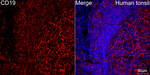 CD19 Antibody in Immunohistochemistry (Paraffin) (IHC (P))