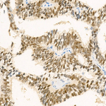 Nkx3.1 Recombinant Rabbit Monoclonal Antibody (6T0Z1)