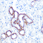 C1QBP Antibody in Immunohistochemistry (Paraffin) (IHC (P))
