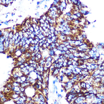 C1QBP Recombinant Rabbit Monoclonal Antibody (4T1W10)