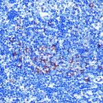 C1QBP Antibody in Immunohistochemistry (Paraffin) (IHC (P))