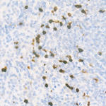 S100A9 Recombinant Rabbit Monoclonal Antibody (6U2X9)