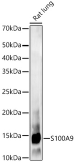 S100A9 Antibody in Western Blot (WB)