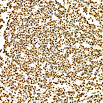 RBMX Antibody in Immunohistochemistry (Paraffin) (IHC (P))