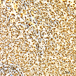 RBMX Antibody in Immunohistochemistry (Paraffin) (IHC (P))