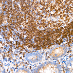 CD74 Antibody in Immunohistochemistry (Paraffin) (IHC (P))