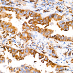 CD74 Antibody in Immunohistochemistry (Paraffin) (IHC (P))