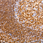 CD74 Antibody in Immunohistochemistry (Paraffin) (IHC (P))