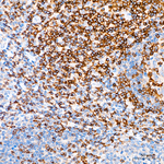 CD3 Antibody in Immunohistochemistry (Paraffin) (IHC (P))