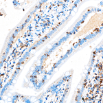CD3 Antibody in Immunohistochemistry (Paraffin) (IHC (P))