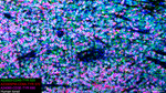 CD3 Antibody in Multiplex Immunohistochemistry (mIHC)