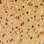 NRGN Recombinant Rabbit Monoclonal Antibody (9J7J6)
