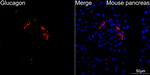 Glucagon Recombinant Rabbit Monoclonal Antibody (1D6I0)
