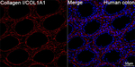 COL1A1 Antibody in Immunohistochemistry (Paraffin) (IHC (P))